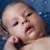 Baby Skin Care